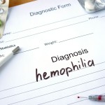 Čo by ste mali vedieť o hemofílii?